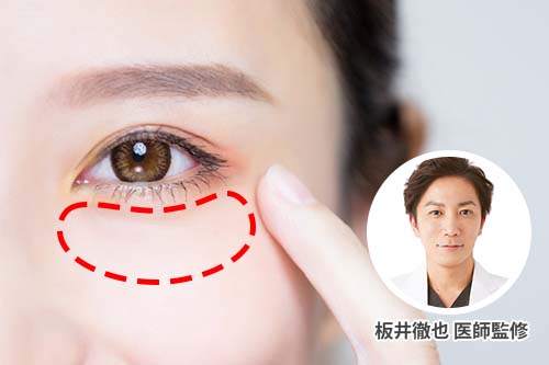 目のまわりにできるブツブツ稗粒腫 はいりゅうしゅ とは Shinagawa Beauty Navi