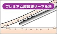 プレミアム超音波サーマル法【画像】