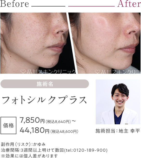 フォトシルクプラス