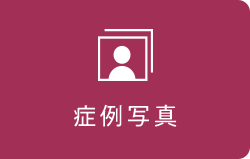 症例写真