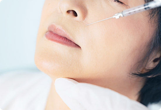 ヒアルロン酸注入