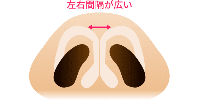 鼻先の幅が広いタイプ【画像】