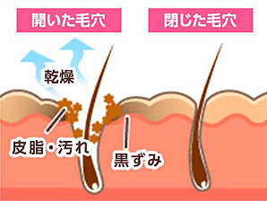 開いた毛穴閉じた毛穴【画像】