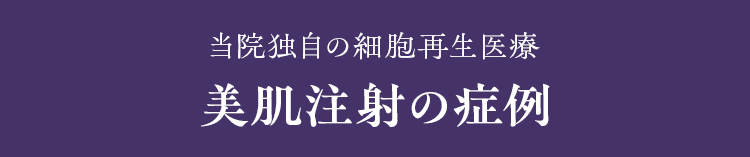 当院独自の細胞再生医療 美肌注射の症例